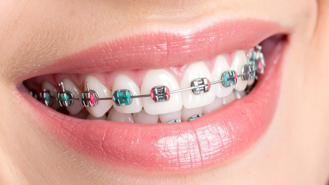 SEO Blog Top Rated Orthodontics